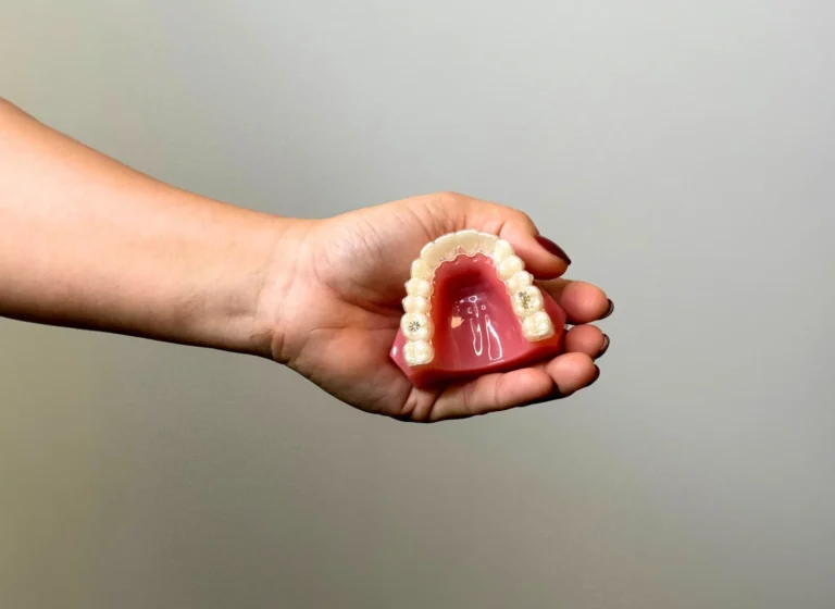 Apparecchio trasparente: le domande più frequenti dei pazienti