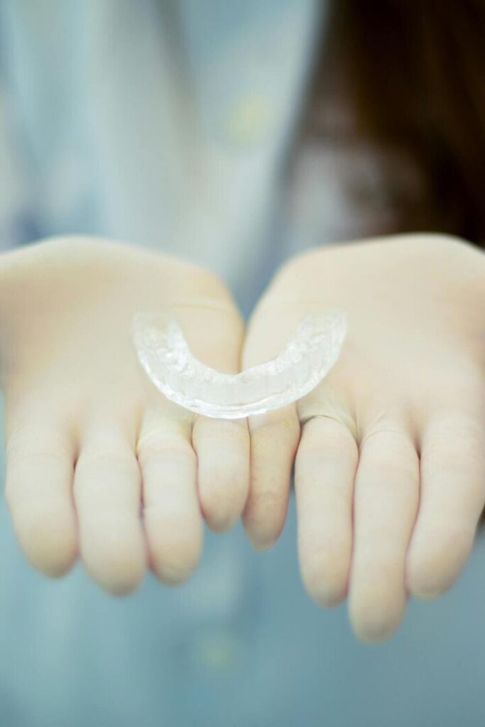 Come funziona l'apparecchio trasparente per i denti 1 Come funziona l'apparecchio trasparente